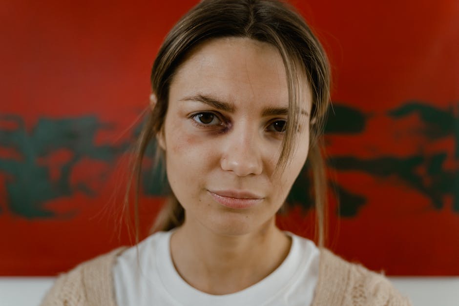 Fighter eye injury Slap fighter injured - 激戦の代償か？スラップファイト中国人選手、眼窩損傷で手術へ