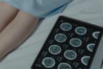 brain MRI medical checkup - 人気番組出演者が末期がん告白、脳転移で治療尽きる「どうか検査を」