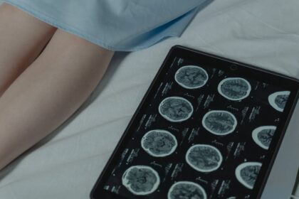 brain MRI medical checkup - 人気番組出演者が末期がん告白、脳転移で治療尽きる「どうか検査を」