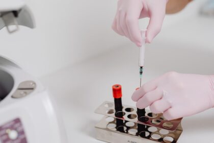 biotechnology lab regenerative medicine - 歴史的転換点！“細胞の若返り”人間臨床試験が開始 ～老化治療の新時代が幕開けか～